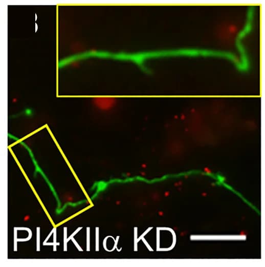Open access visualization of Microscopy, TMR-dextran loading, KD neurons, Primary Cultures, CGNs