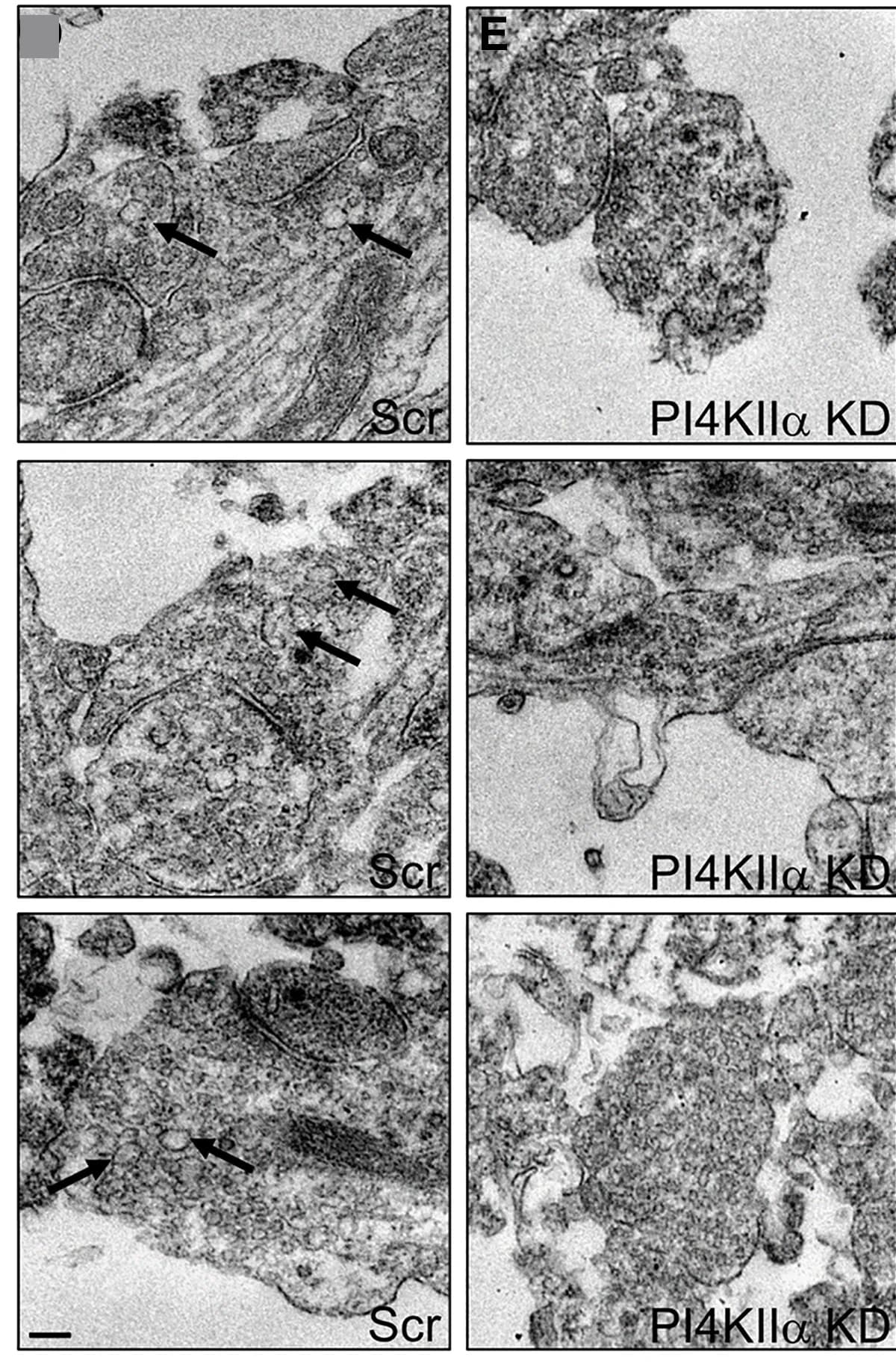 Open access visualization of Microscopy, CGN nerve terminals, Scr, Presynaptic endosomes, Primary Cultures