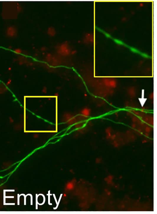Open access visualization of Microscopy, TMR-dextran, Neurons