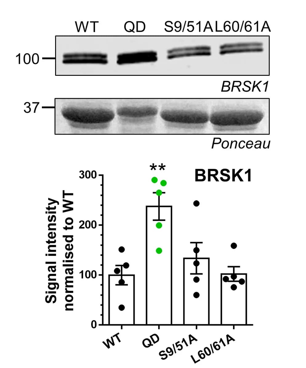 Open access visualization of Bar Plot, Error Bars, Scatter Plot, Western Blots, BRSK1