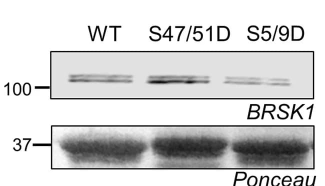 Open access visualization of Gel, Blots, GST fusion proteins, Ponceau