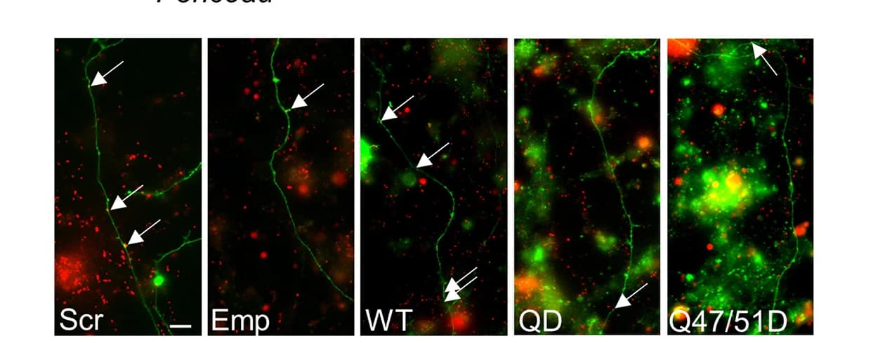 Open access visualization of Microscopy, CGNs, shRNA, PI4KII, Scr control