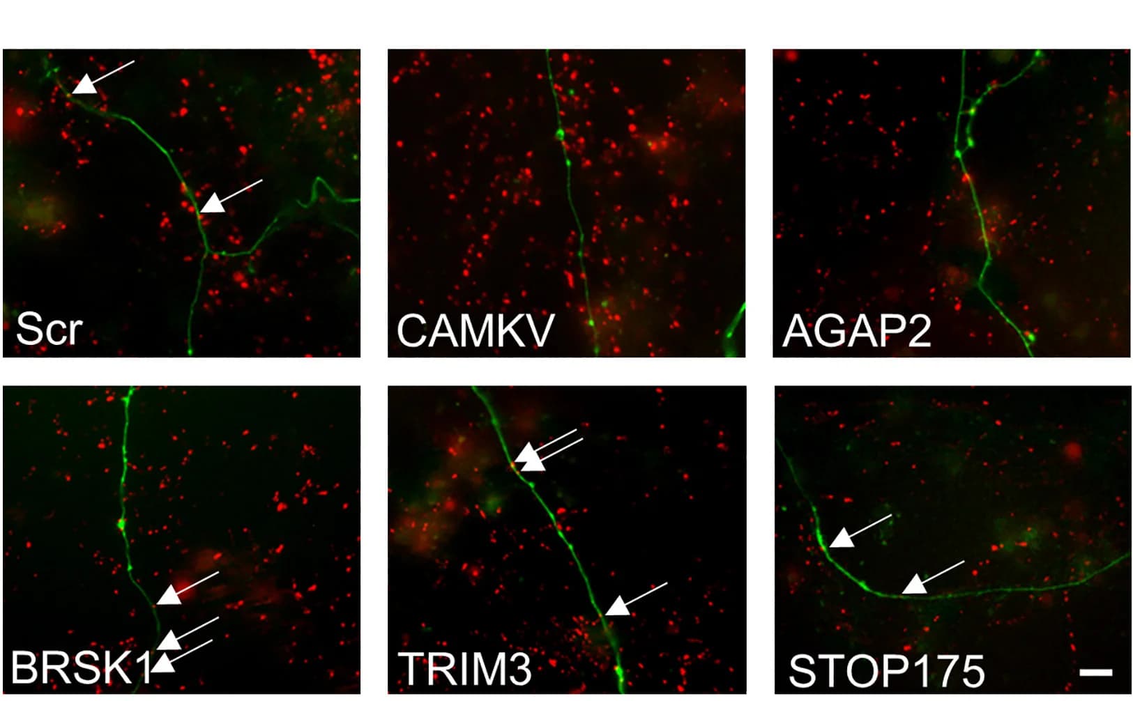 Open access visualization of Microscopy, TMR-dextran, Neurons