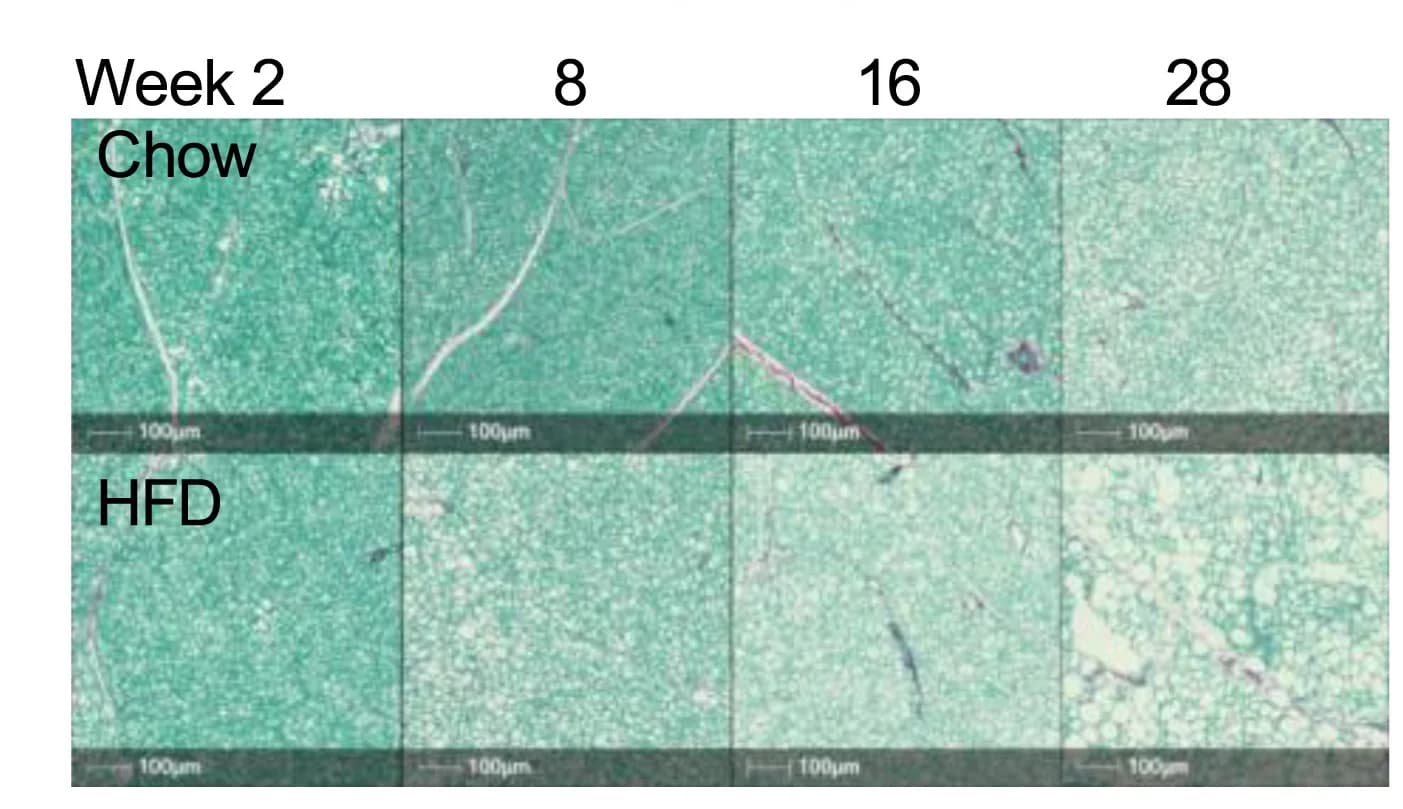 Open access visualization of Microscopy, Sirius Red Staining, BAT, Mice, Chow Diet