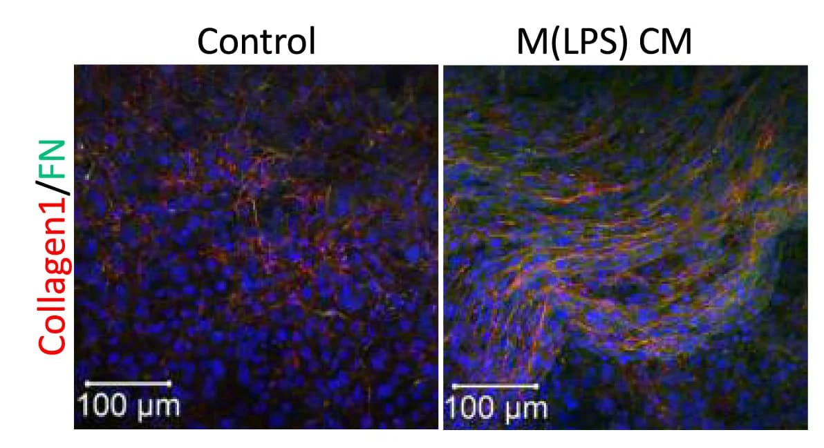 Open access visualization of Microscopy, Confocal Analysis, Collagen Type I, Fibronectin, C57BAT Cells