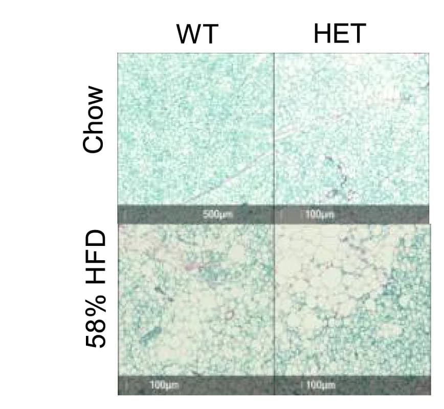 Open access visualization of Microscopy, Sirius Red Staining, Brown Adipose Tissue, PepdWT Mice, HET Mice