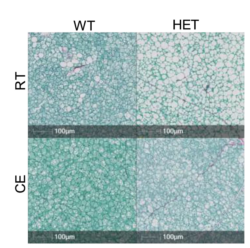 Open access visualization of Microscopy, Red Sirius Staining, Brown Adipose Tissue, Mice, Images