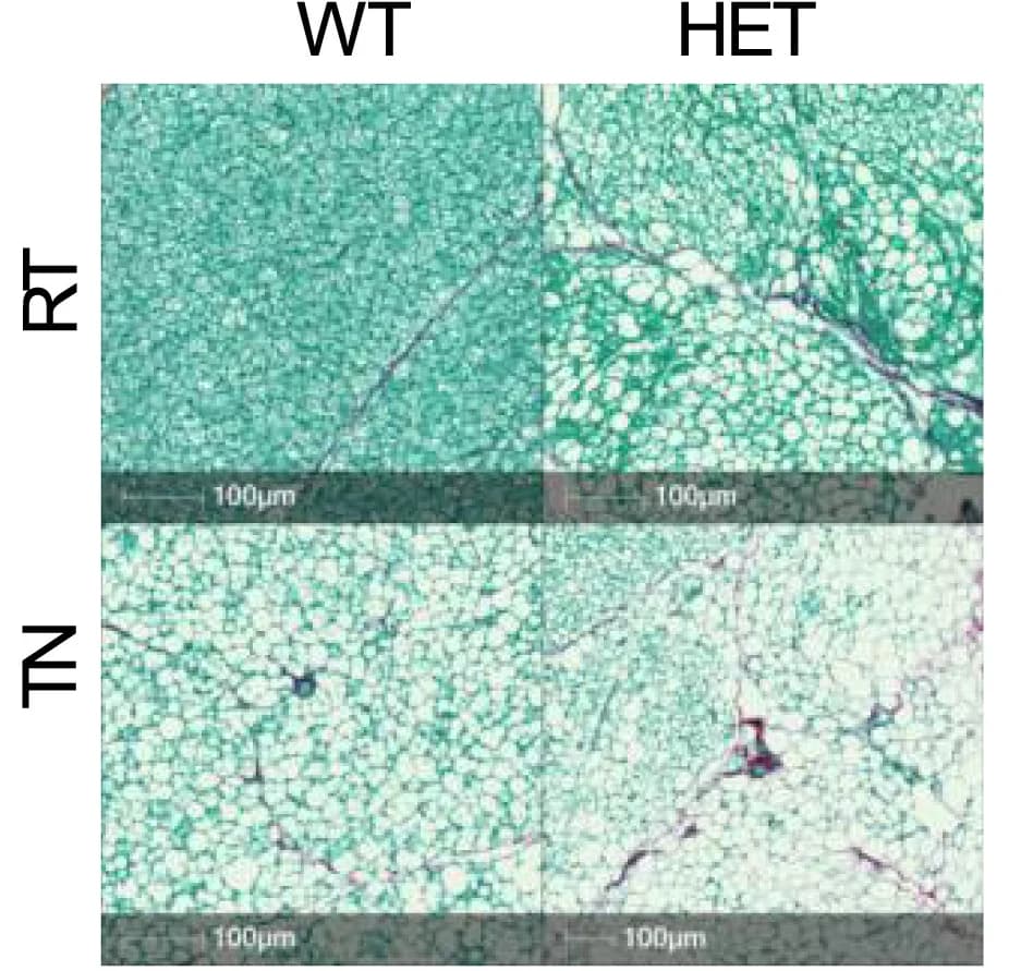 Open access visualization of Microscopy, Sirius Red Staining, BAT, PepdWT Mice, HET Mice