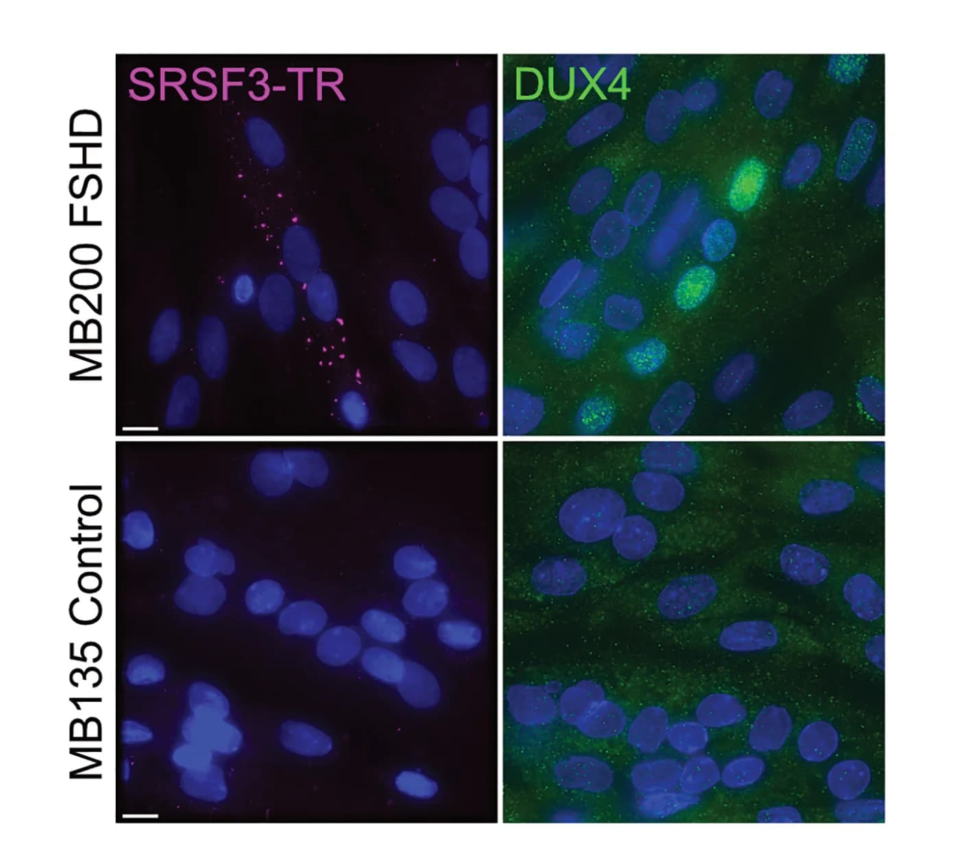 Open access visualization of Microscopy, Immunofluorescence, Myotubes, DAPI, DUX4