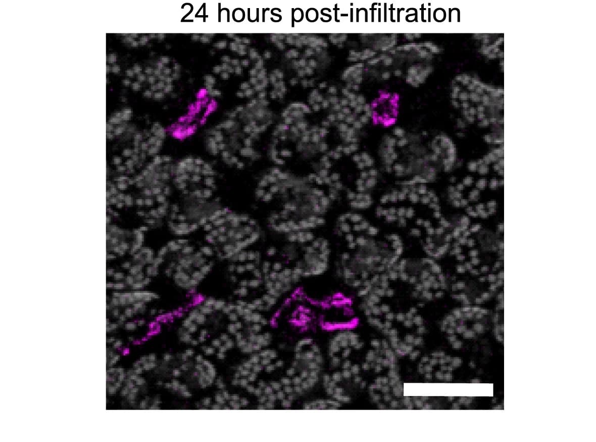 Open access visualization of Microscopy, Arabidopsis Leaf, Confocal Micrograph, PstDC3000, Chlorophyll Autofluorescence