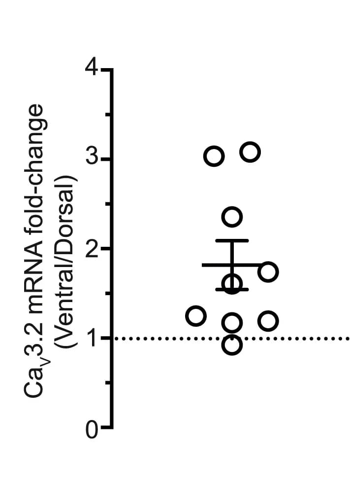 Open access visualization of Scatter Plot, Error Bars, CaV3.2 mRNA, Ventral mEC, Dorsal mEC
