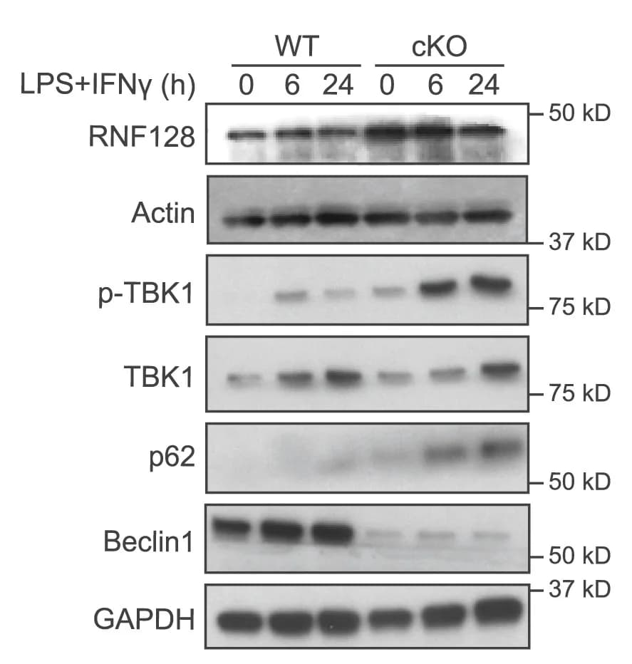 Open access visualization of Gel, BMDMs, Cell Lysates, Immunoblot, Phosphorylation