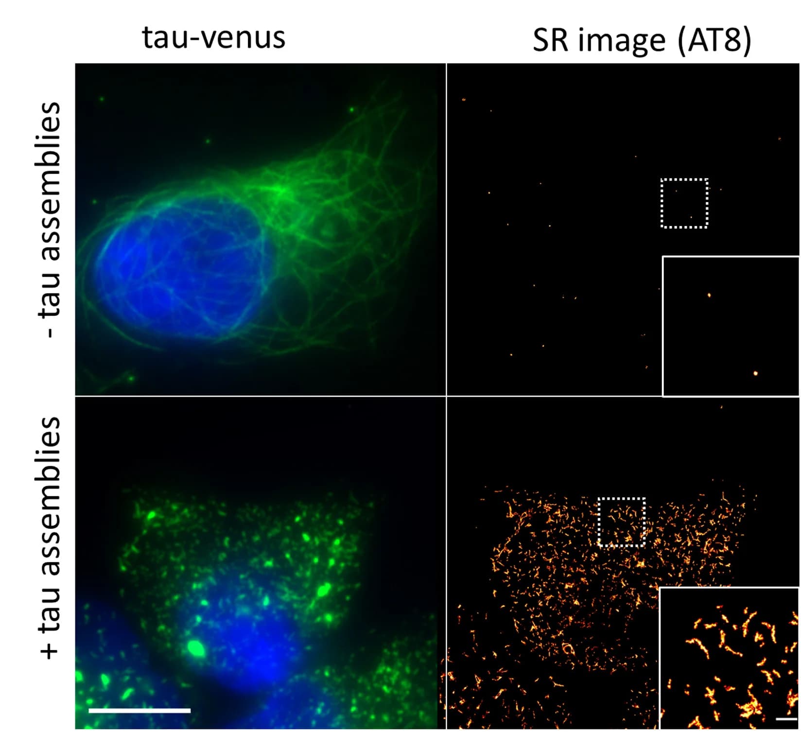 Open access visualization of Microscopy, Diffraction-limited images, SR images, HEK293 cells, P301S tau-Venus
