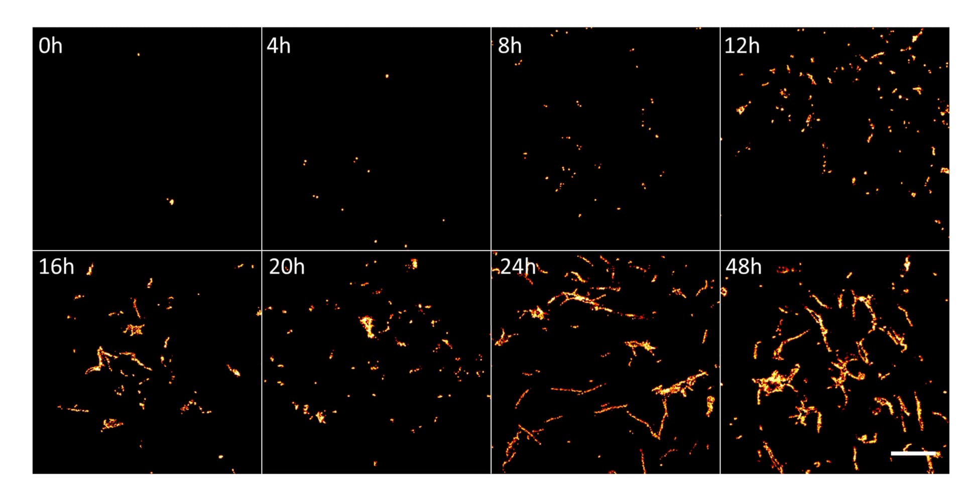 Open access visualization of Microscopy, HEK293 Cells, P301S Tau, Recombinant P301S Tau Fibrils, AT8 Antibody