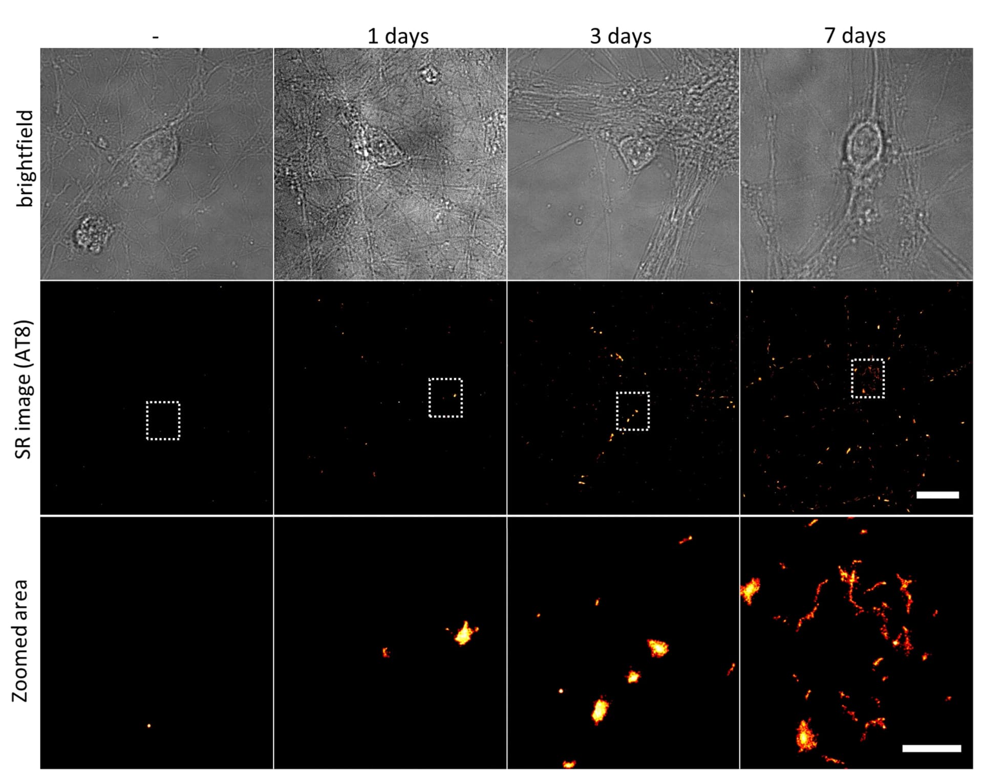Open access visualization of Microscopy, Primary Cultures, Tau Fibrils, Immunostaining, dSTORM Imaging