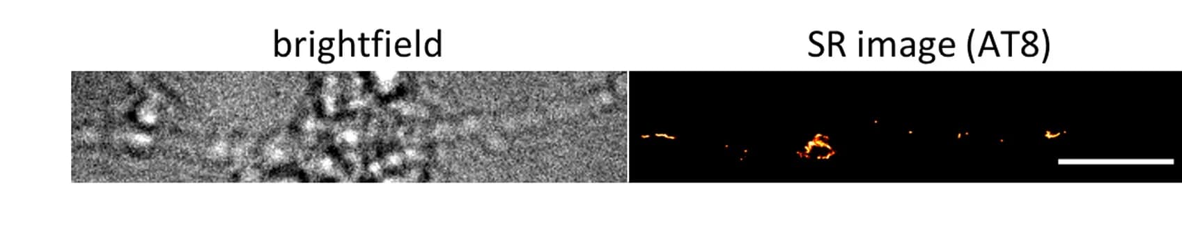 Open access visualization of Microscopy, Bright-Field Images, SR Images, Tau Aggregates, Neuronal Processes