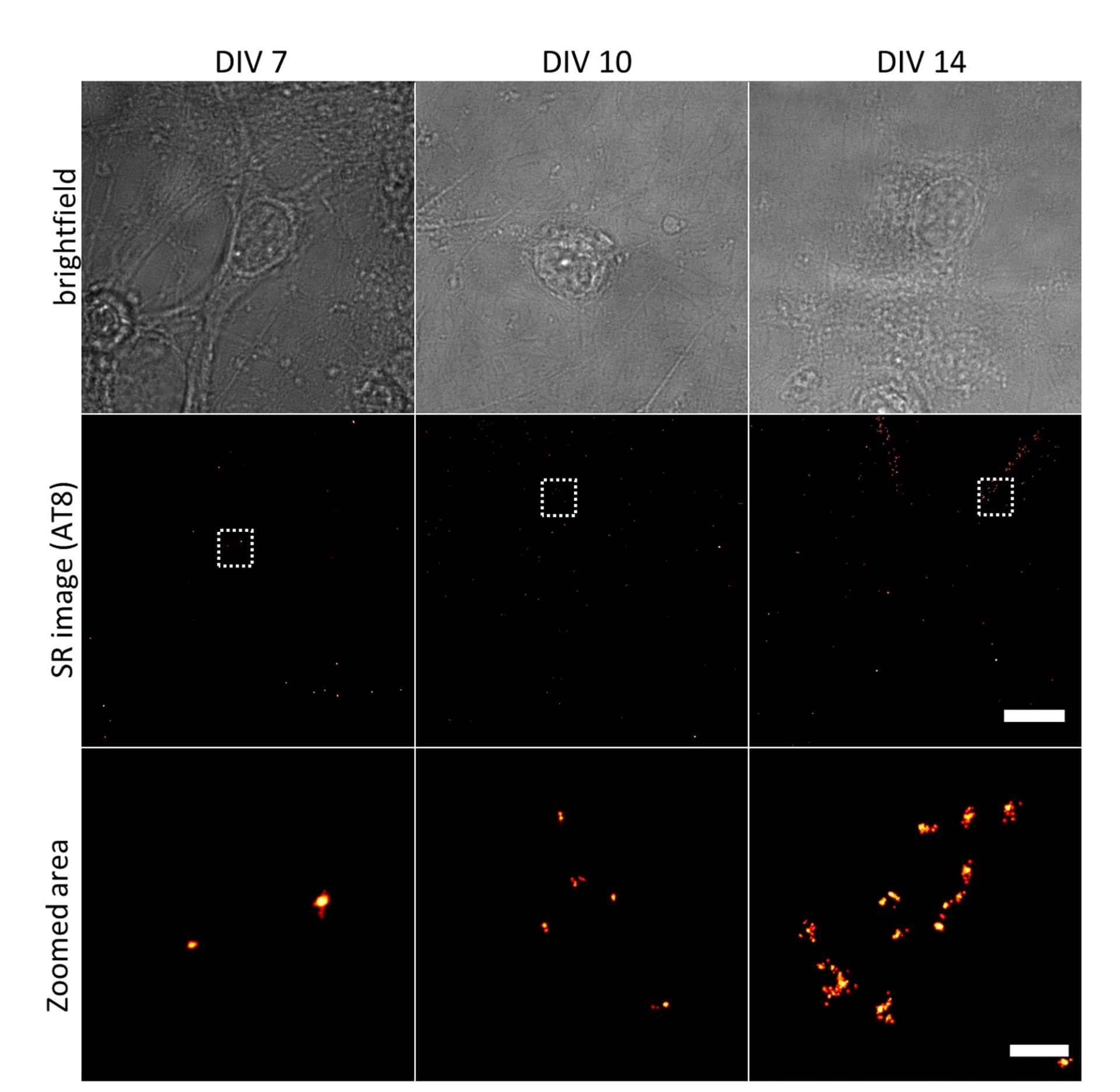 Open access visualization of Microscopy, Primary Cultures, Transgenic Mice, Immunostaining, dSTORM Imaging