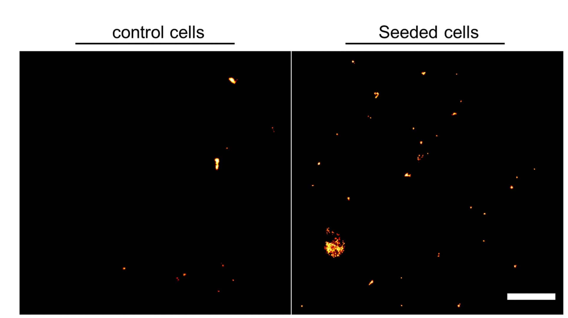 Open access visualization of Microscopy, HEK293 Cells, Tau, dSTORM, P301S Tau Fibrils