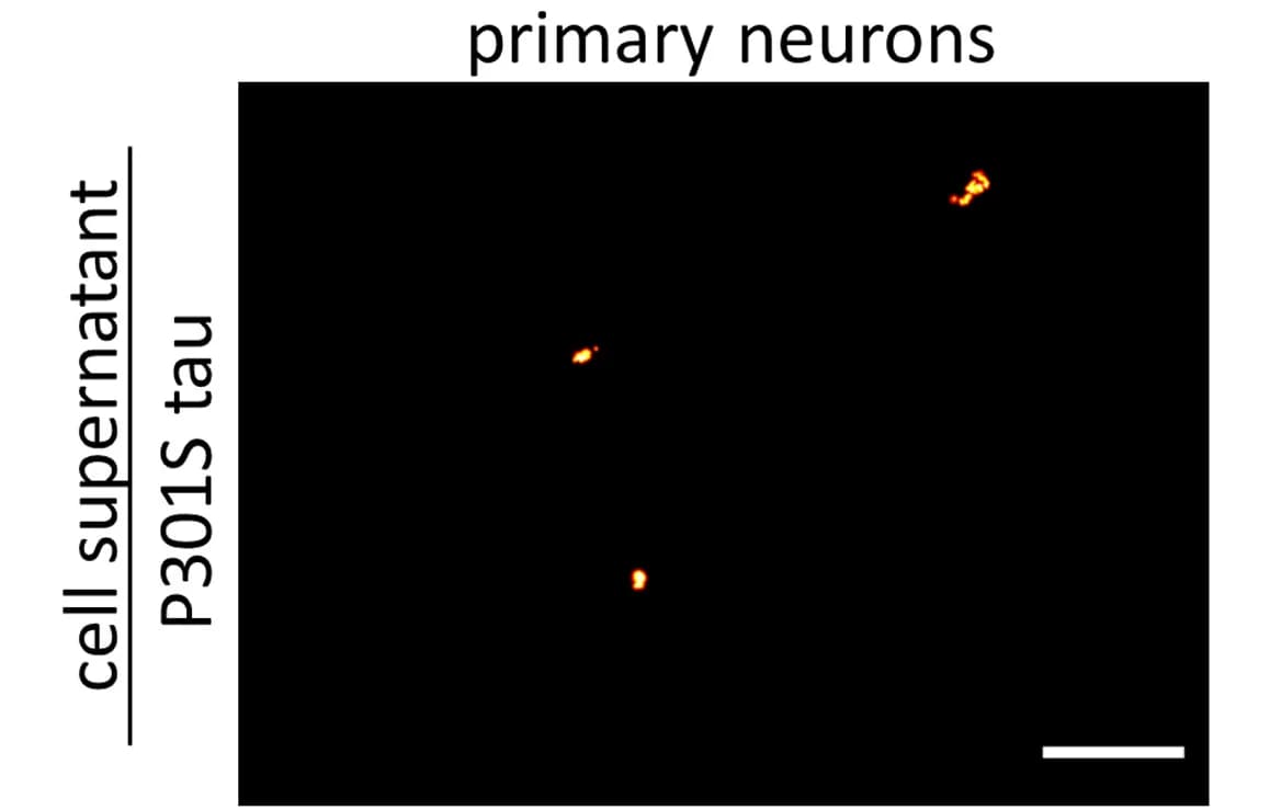 Open access visualization of Microscopy, Cell Supernatant, Primary Neurons, Treatment