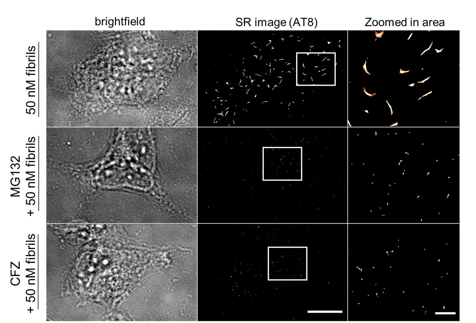 Open access visualization of Microscopy, Bright-field, AT8-STORM, HEK293 Cells, P301S Tau