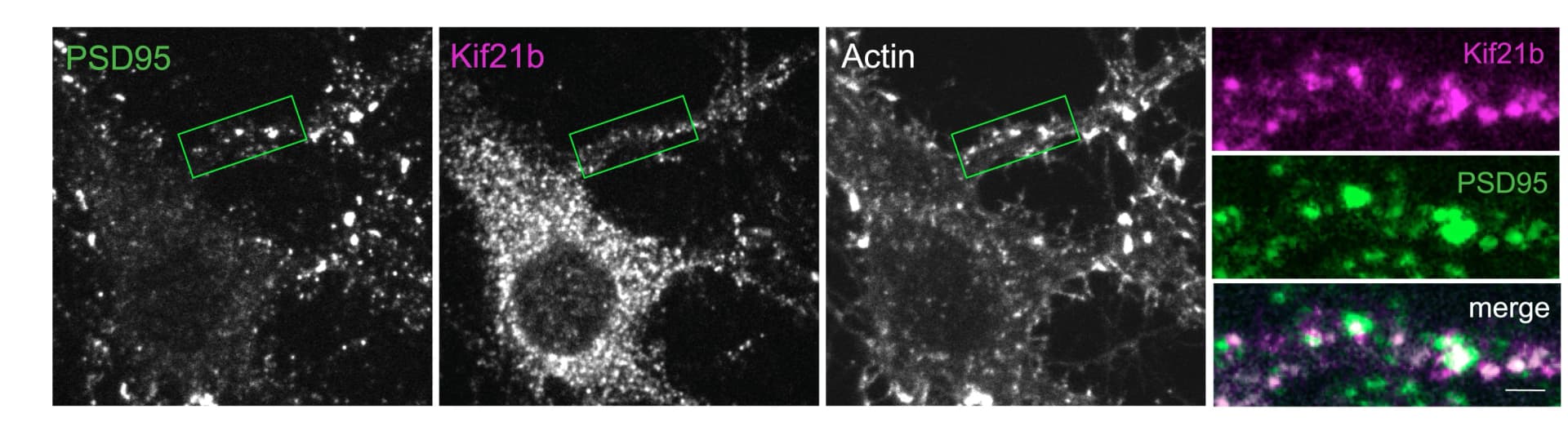 Open access visualization of Microscopy, Hippocampal Neurons, Antibodies, PSD95, Actin