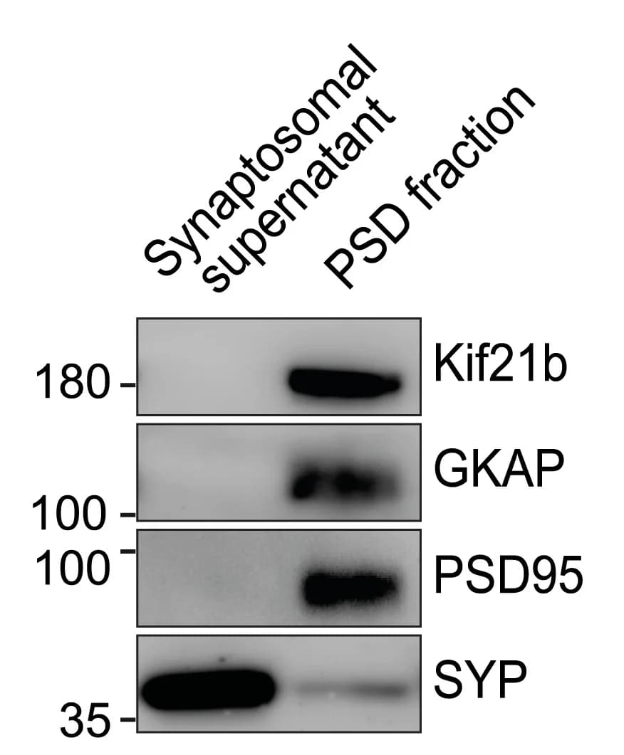 Open access visualization of Gel, Western Blot, Postsynaptic Density, Hippocampal Tissue, Synaptophysin