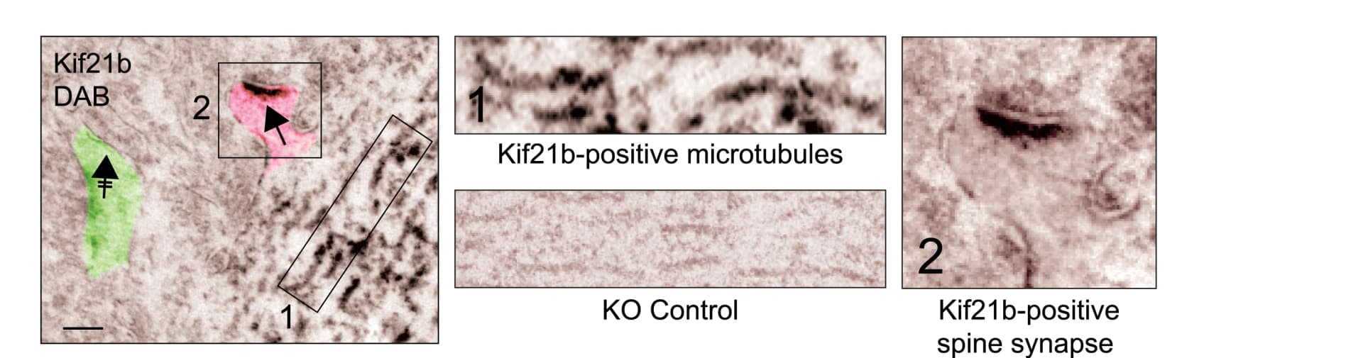 Open access visualization of Microscopy, Immunoelectron Microscopy, Diaminobenzidine, Hippocampal Slices, Microtubules