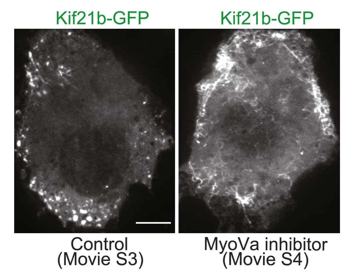 Open access visualization of Microscopy, Time-Lapse Video Microscopy, COS-7 Cells, Kif21b-GFP, DMSO