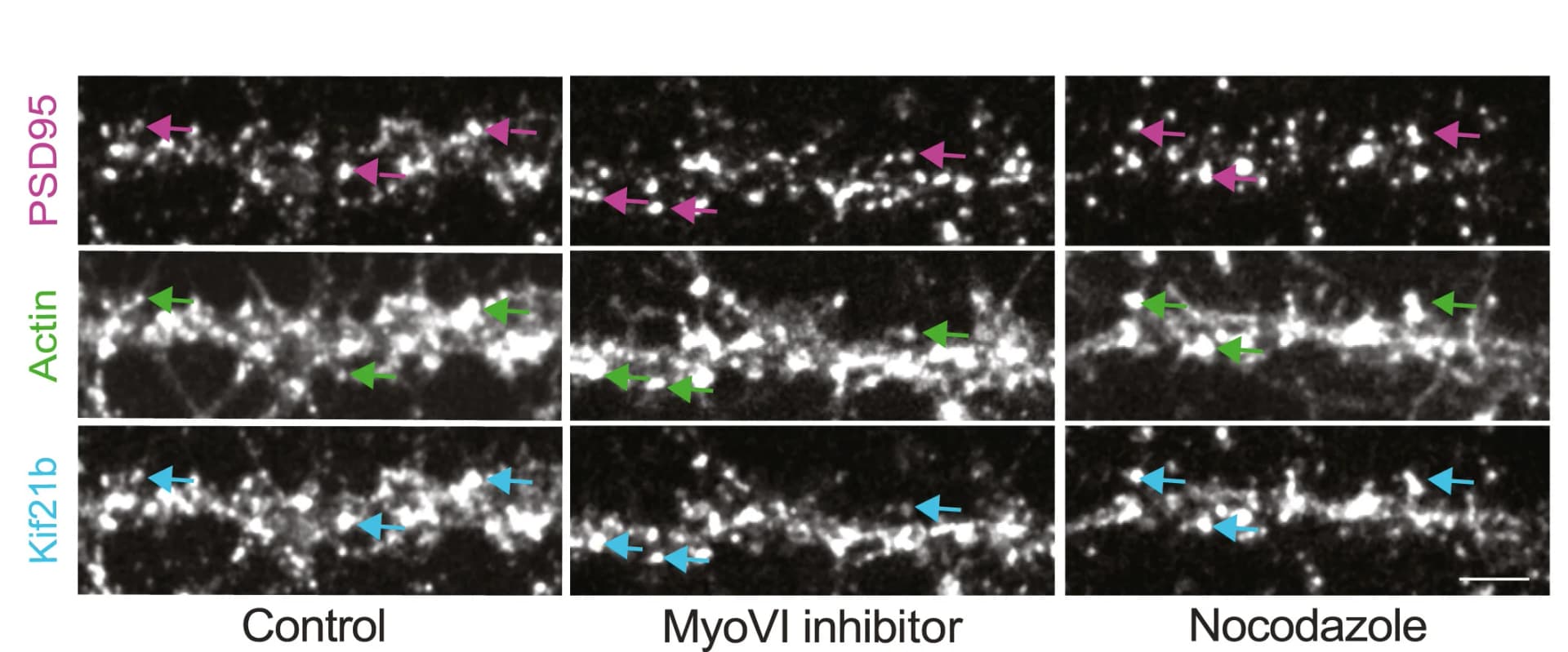 Open access visualization of Microscopy, Hippocampal Neurons, PSD95, Antibodies, Kif21b