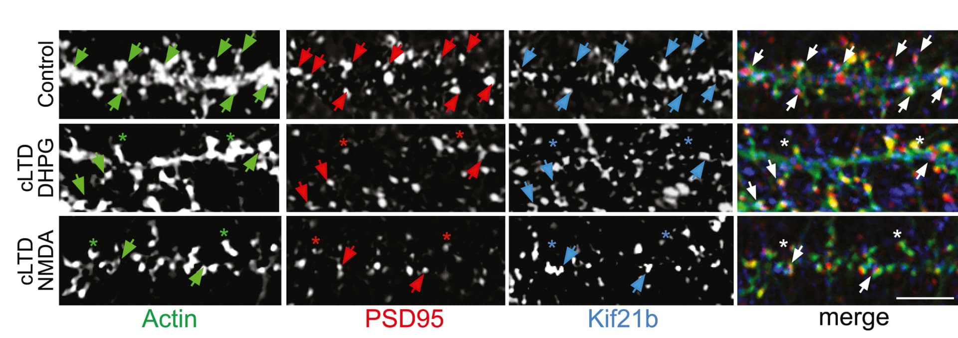 Open access visualization of Microscopy, Hippocampal Neurons, Phalloidin, Actin, PSD95