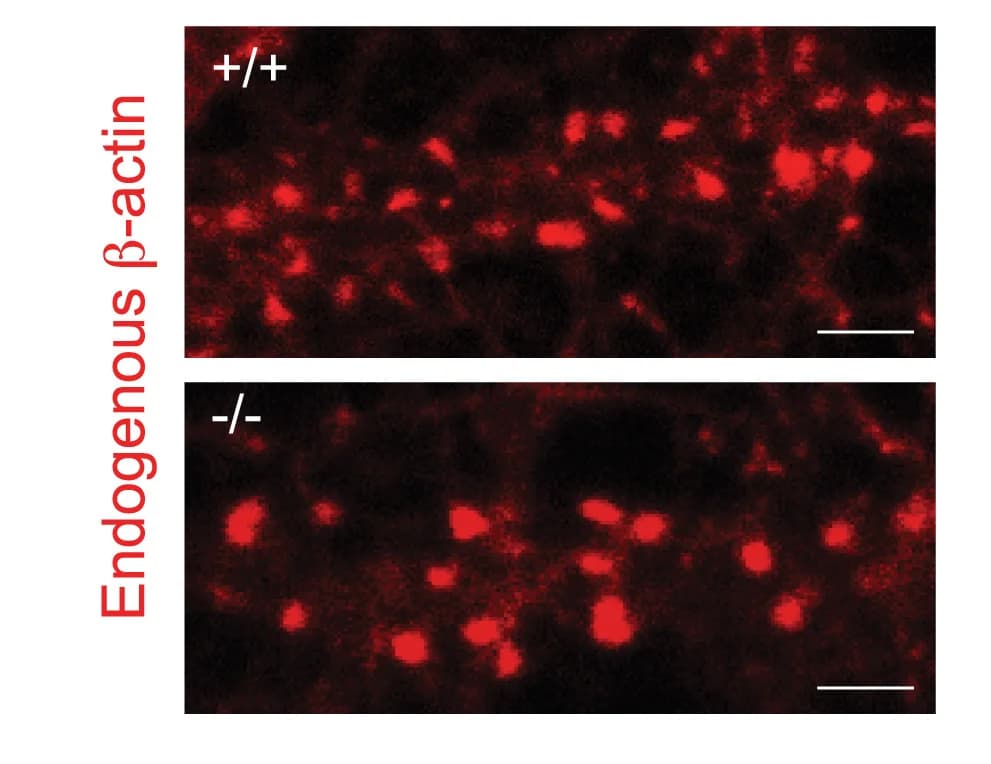 Open access visualization of Microscopy, Dendritic Protrusions, Hippocampal Neurons, Actin, Phalloidin