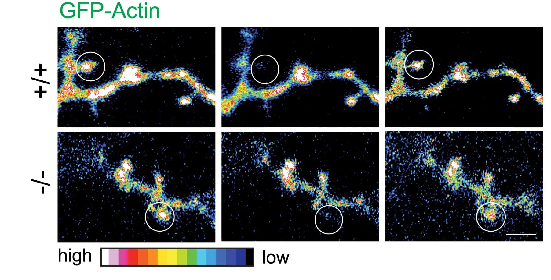 Open access visualization of Microscopy, Spine Heads, GFP-Actin, Hippocampal Neurons, FRAP Imaging
