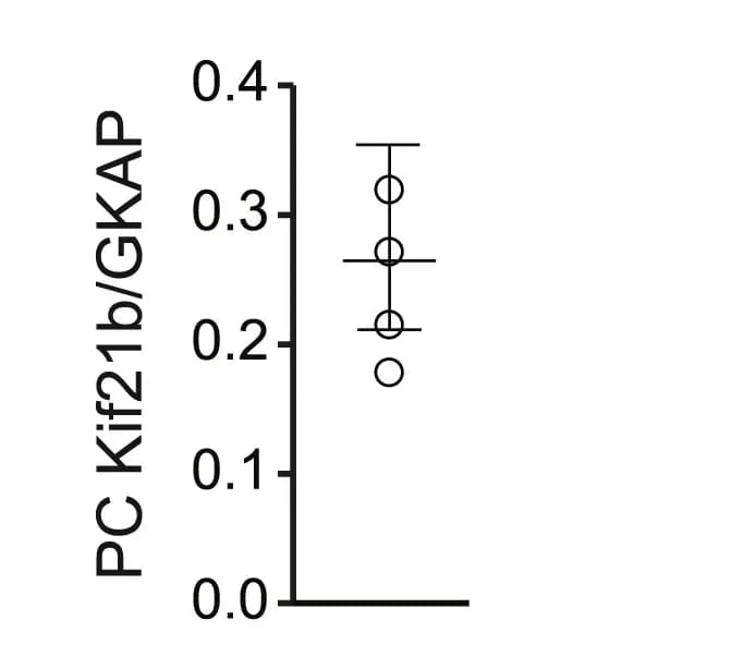 Open access visualization of Scatter Plot, Error Bars, Pearson's Correlation Coefficient, Quantification, Hippocampal Neurons