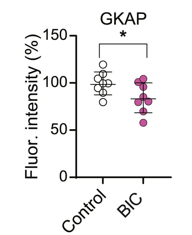 Open access visualization of Scatter Plot, Fluorescent Intensity, GKAP, Actin, Spines