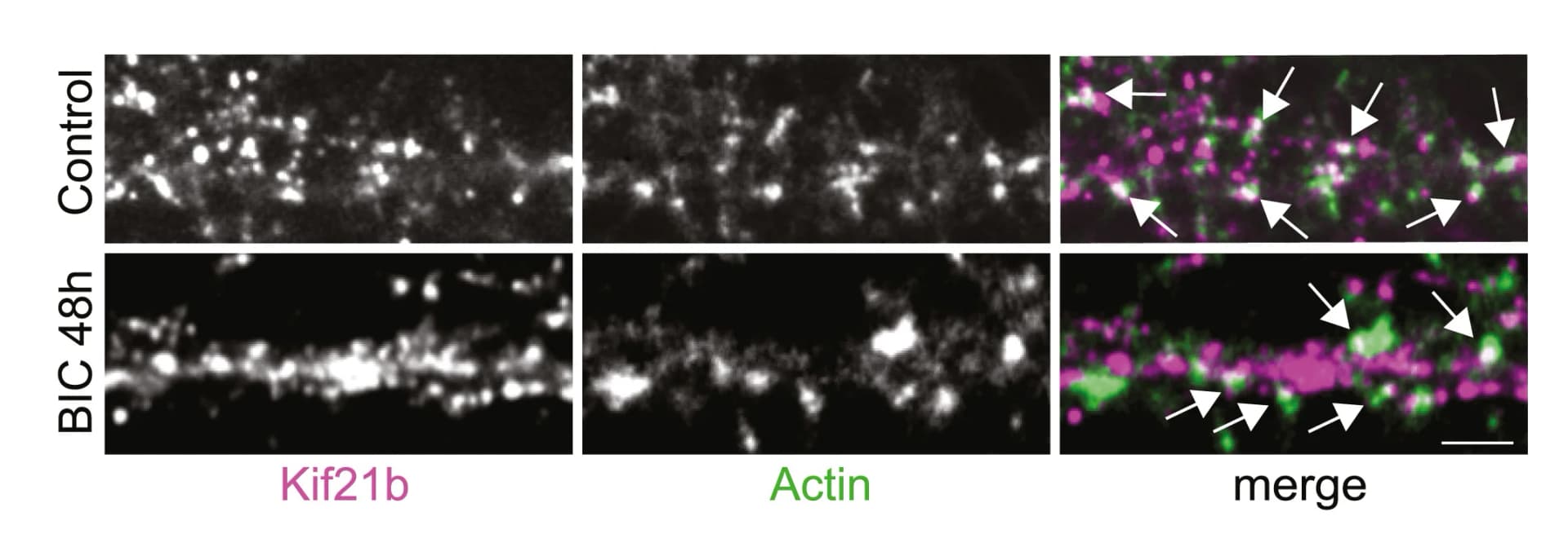 Open access visualization of Microscopy, Hippocampal Neurons, DIV14-16, Kif21b, Actin