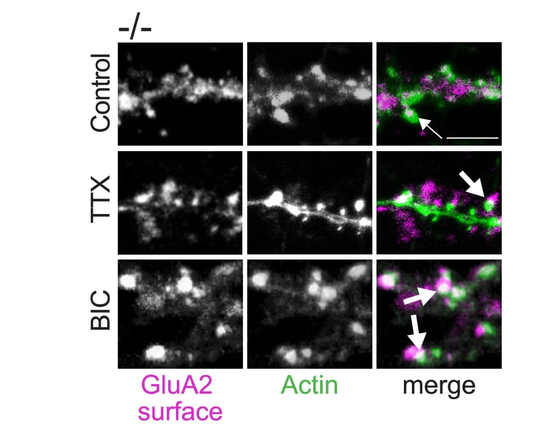 Open access visualization of Microscopy, Kif21b knockout Neurons, Hippocampal Neurons, GluA2 Antibodies, Phalloidin