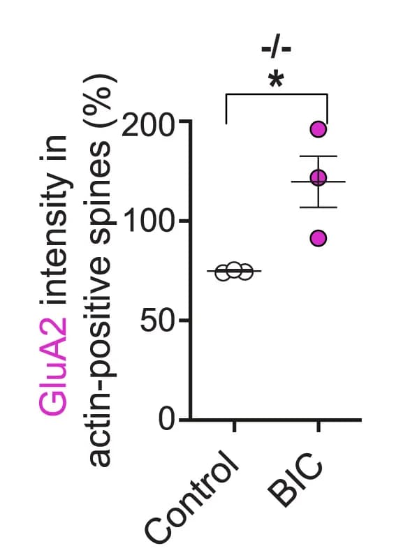Open access visualization of Scatter Plot, Error Bars, Cell Surface, GluA2 Fluorescence Intensity, Spines
