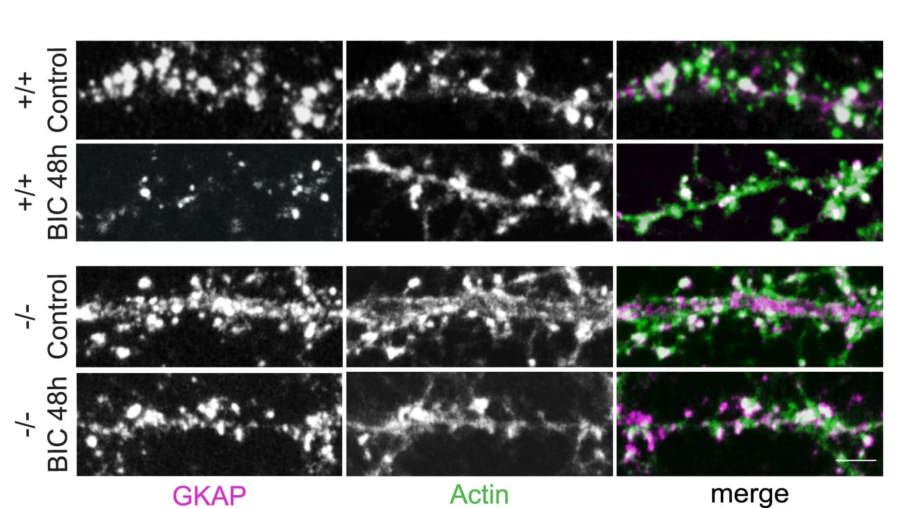 Open access visualization of Microscopy, Hippocampal Neurons, GKAP Antibodies, Actin Antibodies, DMSO