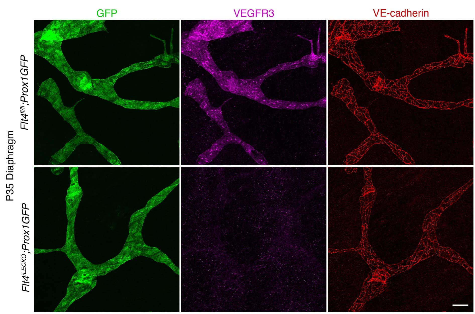 Open access visualization of Microscopy, P35 Diaphragms, Immunostaining, GFP, VEGFR3