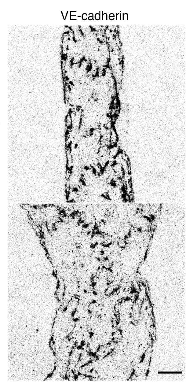 Open access visualization of Microscopy, Junction Phenotype, Lymphatic Capillaries, Magnification