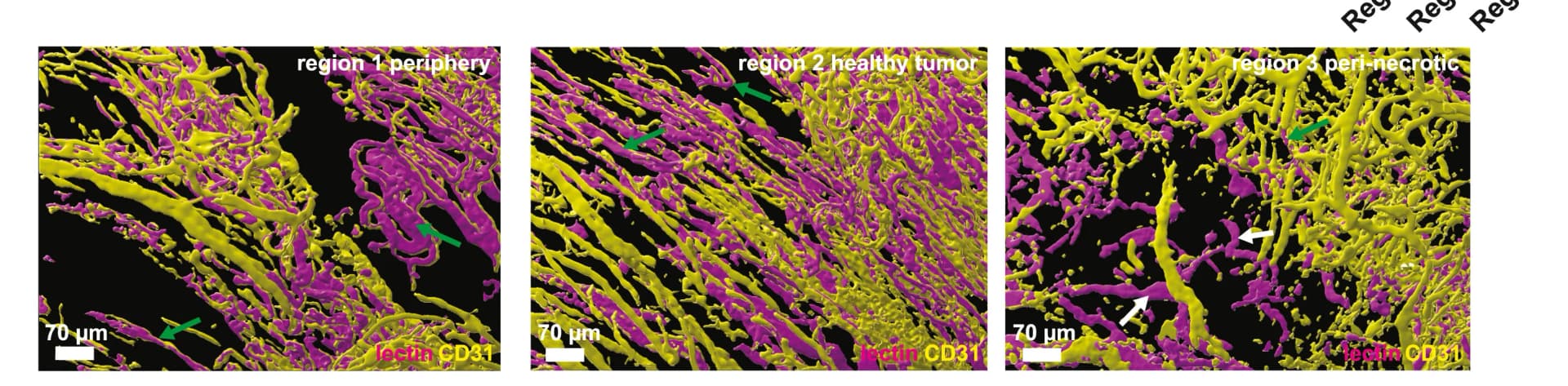 Open access visualization of Microscopy, 3D Rendering, CD31, Lectin, VM Vessel Volume