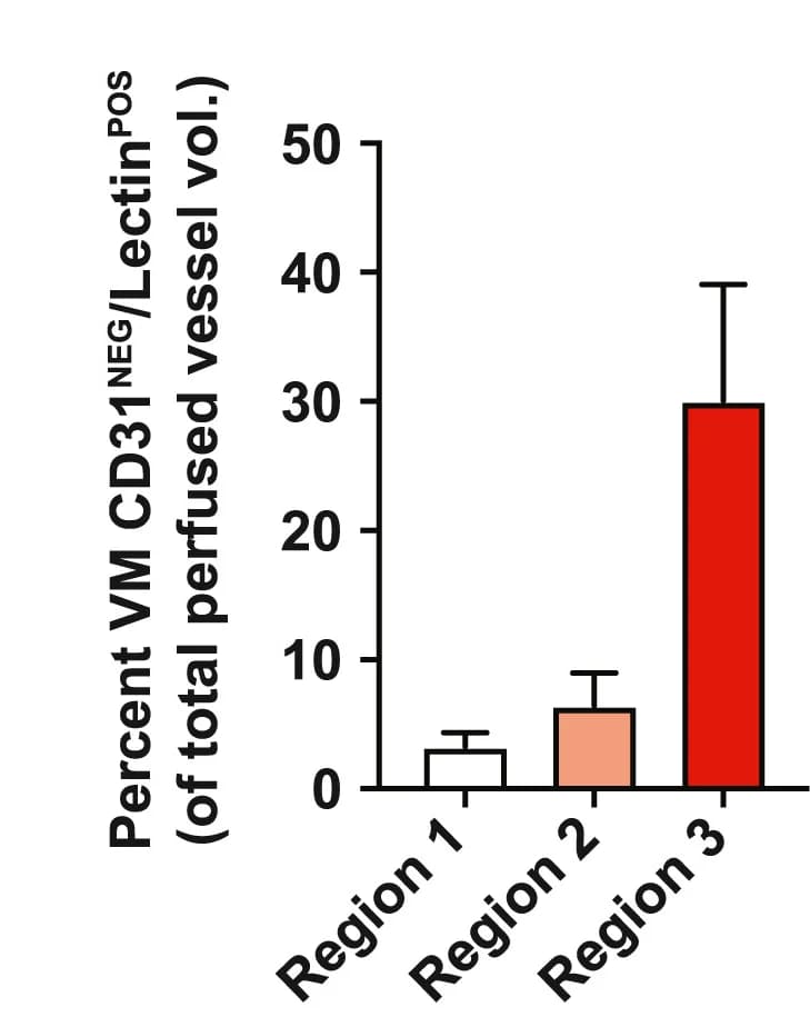 Open access visualization of Bar Plot, Error Bars, VM Vessels, Tumor Regions, CD31 Positive