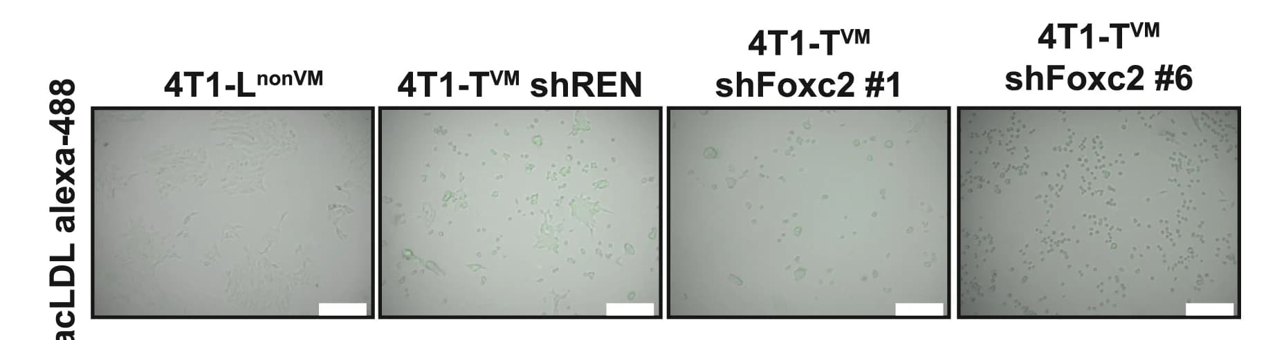 Open access visualization of Microscopy, Fluorescent Images, Alexa 488-labeled acLDL Uptake Assays, 4T1-LnonVMor Cells, 4T1-TVM Cells