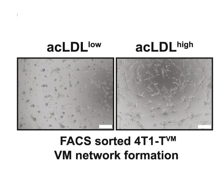 Open access visualization of Microscopy, Matrigel Network Formation Assays, 4T1-TVM Cells, acLDL Uptake
