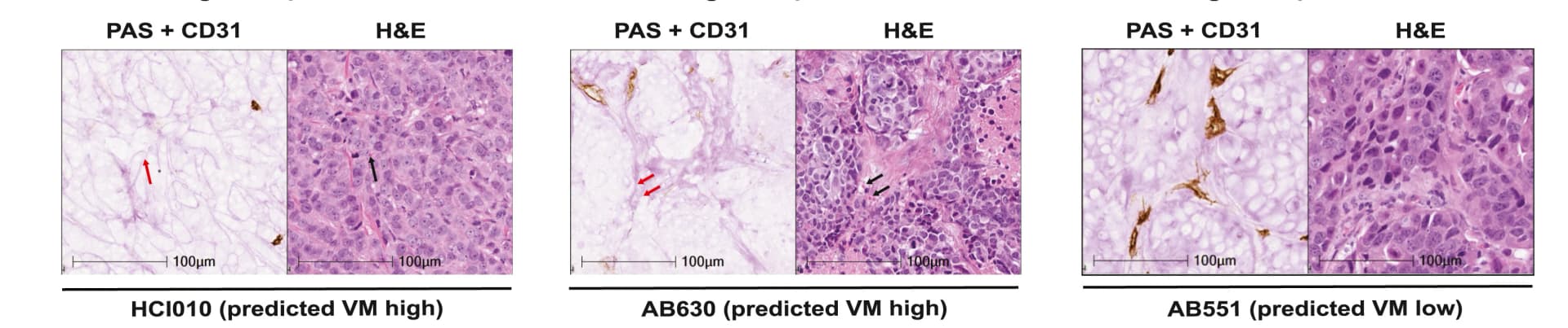 Open access visualization of Microscopy, CD31/PAS Staining, H&E Staining, PDTXs