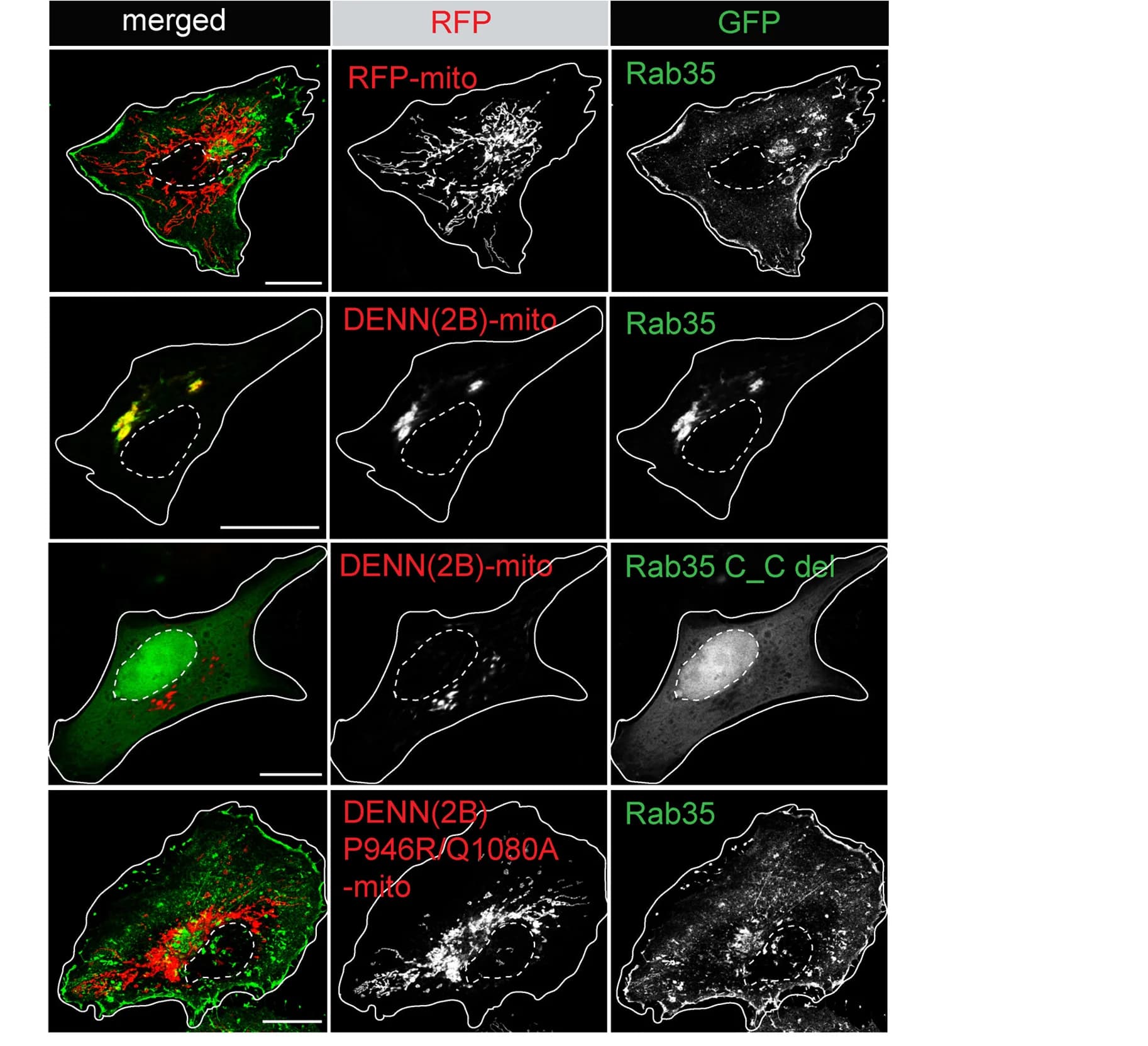 Open access visualization of Microscopy, HeLa Cells, GFP-Rab35, RFP-mito, DENN(2B)-mito