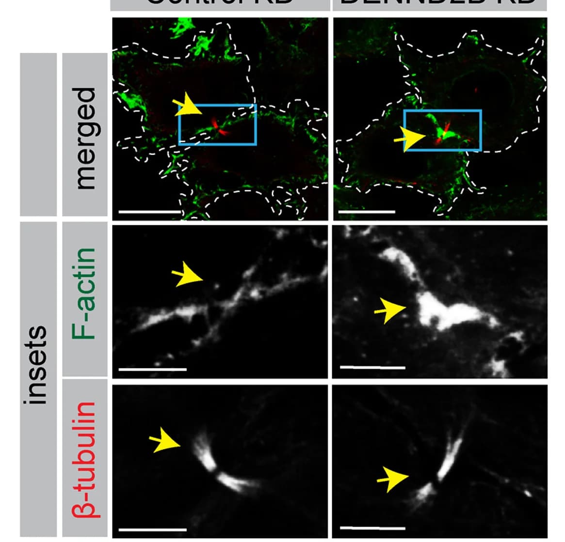 Open access visualization of Microscopy, HeLa Cells, DENND2B shRNA lentivirus, Phalloidin, F-actin