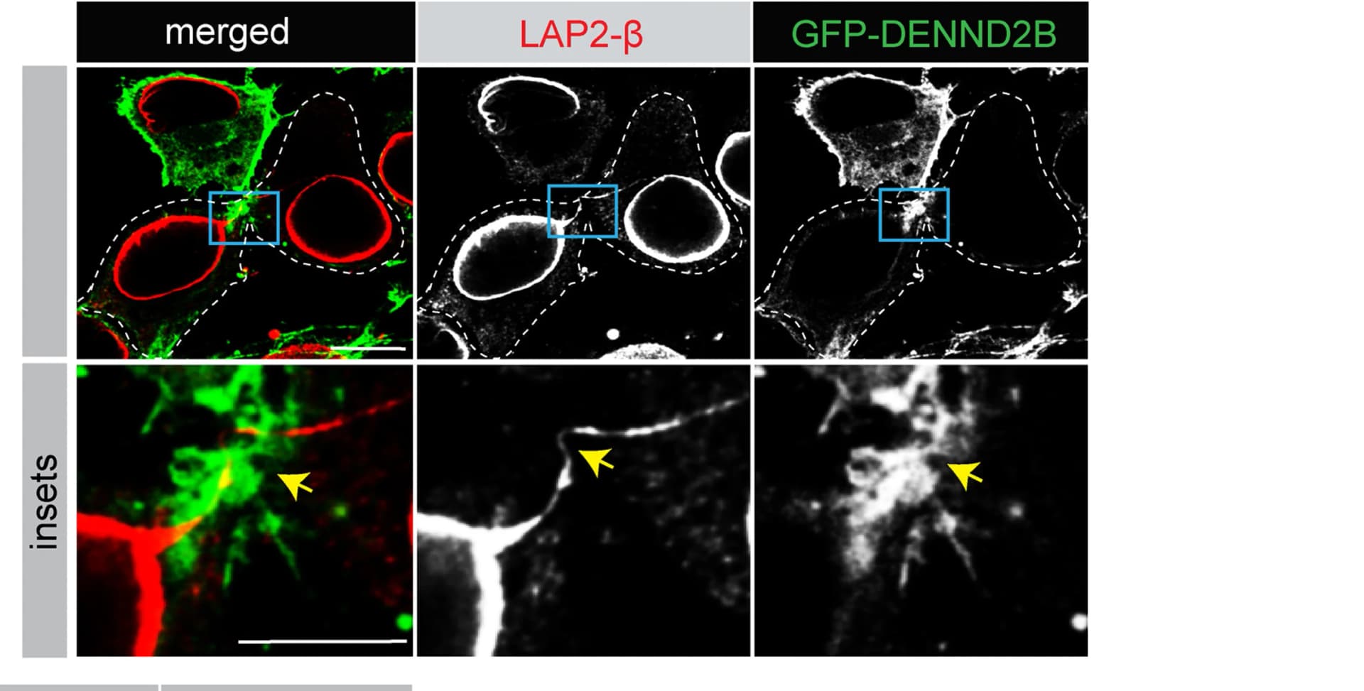 Open access visualization of Microscopy, HeLa Cells, Lentivirus, GFP-DENDN2B, LAP2-β