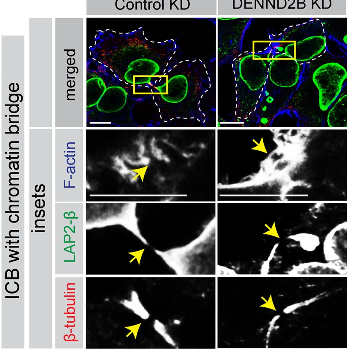 Open access visualization of Microscopy, HeLa Cells, Control shRNA, DENND2B shRNA, Lentivirus