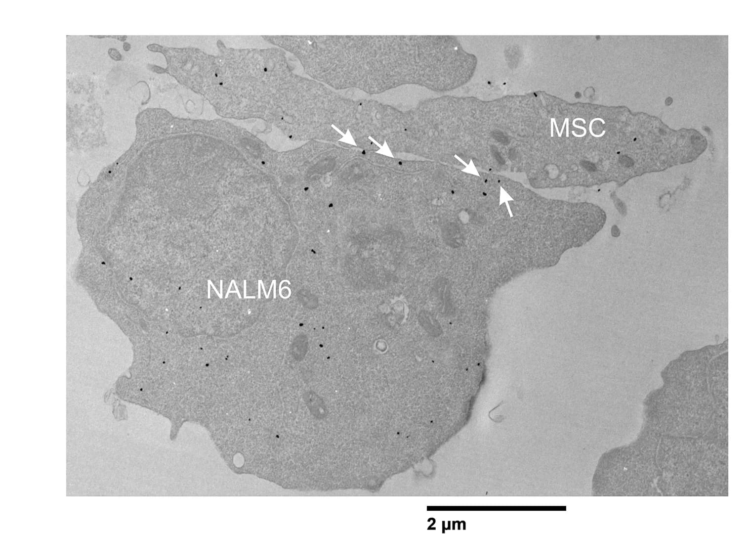 Open access visualization of Microscopy, TEM, Integrin β1, NALM6 Cells, MSCs
